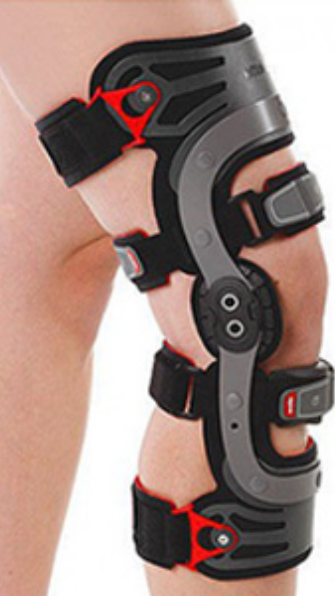 Rodilla